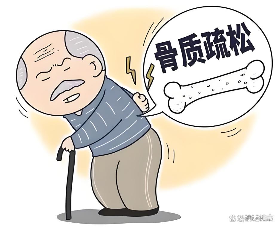 中老年补钙防疏松：强健骨骼，行动自如
